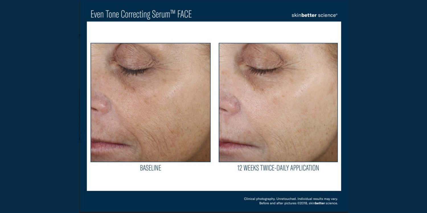 The Pros and Cons of the SKINBETTER SCIENCE Rejuvenate Even Tone Correcting Serum