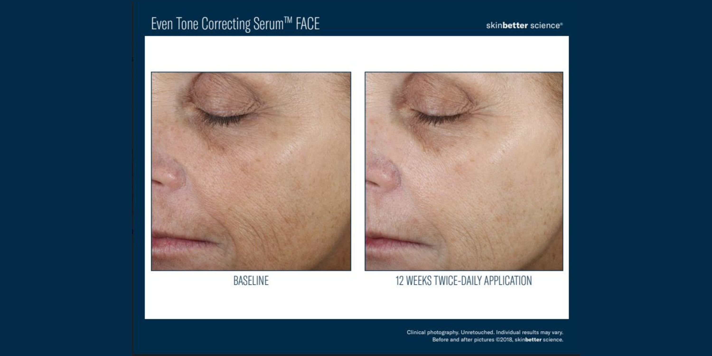 The Pros and Cons of the SKINBETTER SCIENCE Rejuvenate Even Tone Correcting Serum