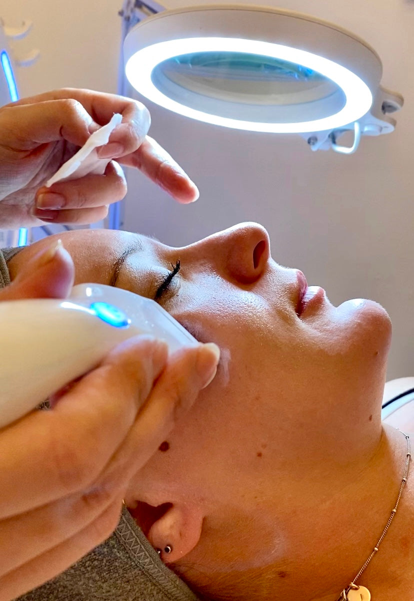 Skin Peels: Beautologys' guide