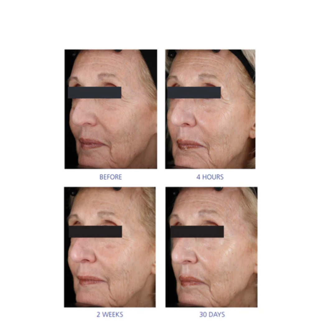 is-clinical-youth-eye-complex