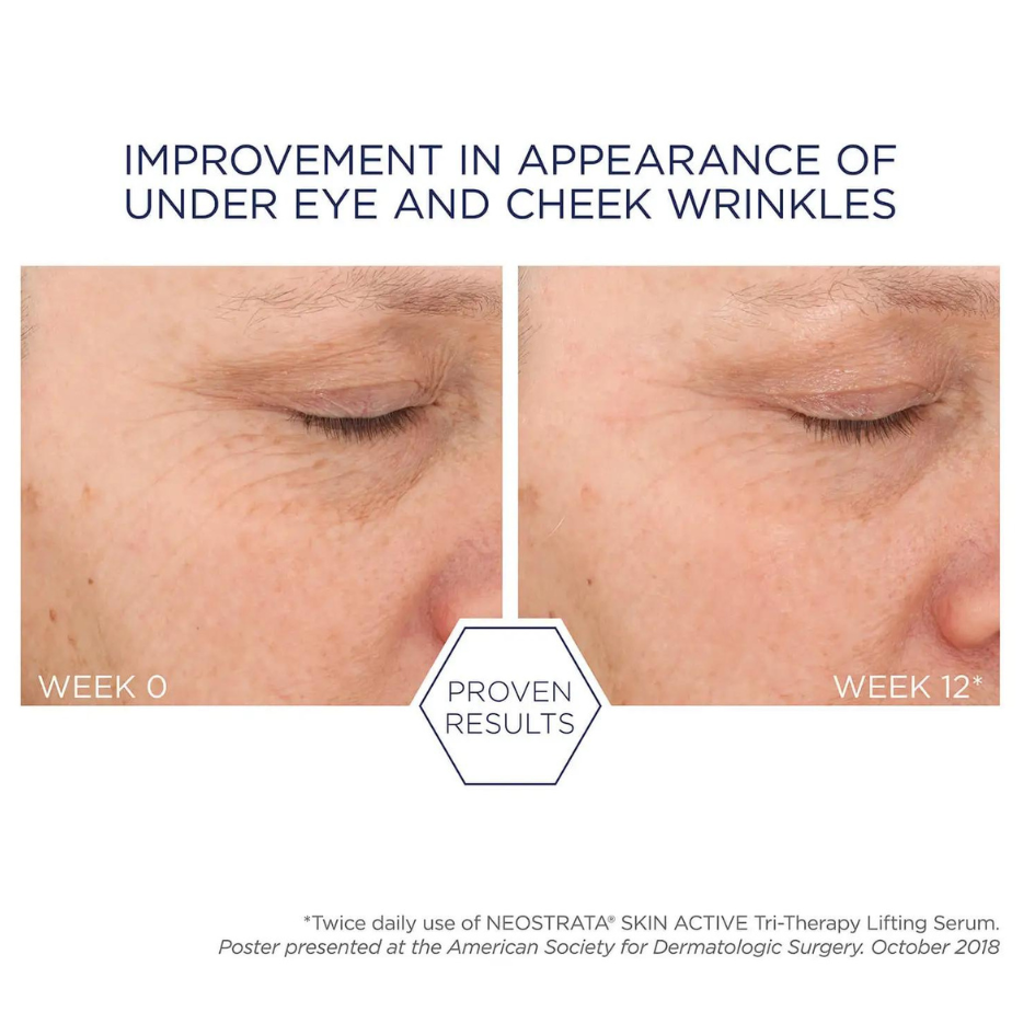 NEOSTRATA Skin Active FIRMING Tri-Therapy Lifting Serum 30ml: Advanced firming serum for a lifted and rejuvenated complexion, promoting skin elasticity and reducing the appearance of fine lines and wrinkles