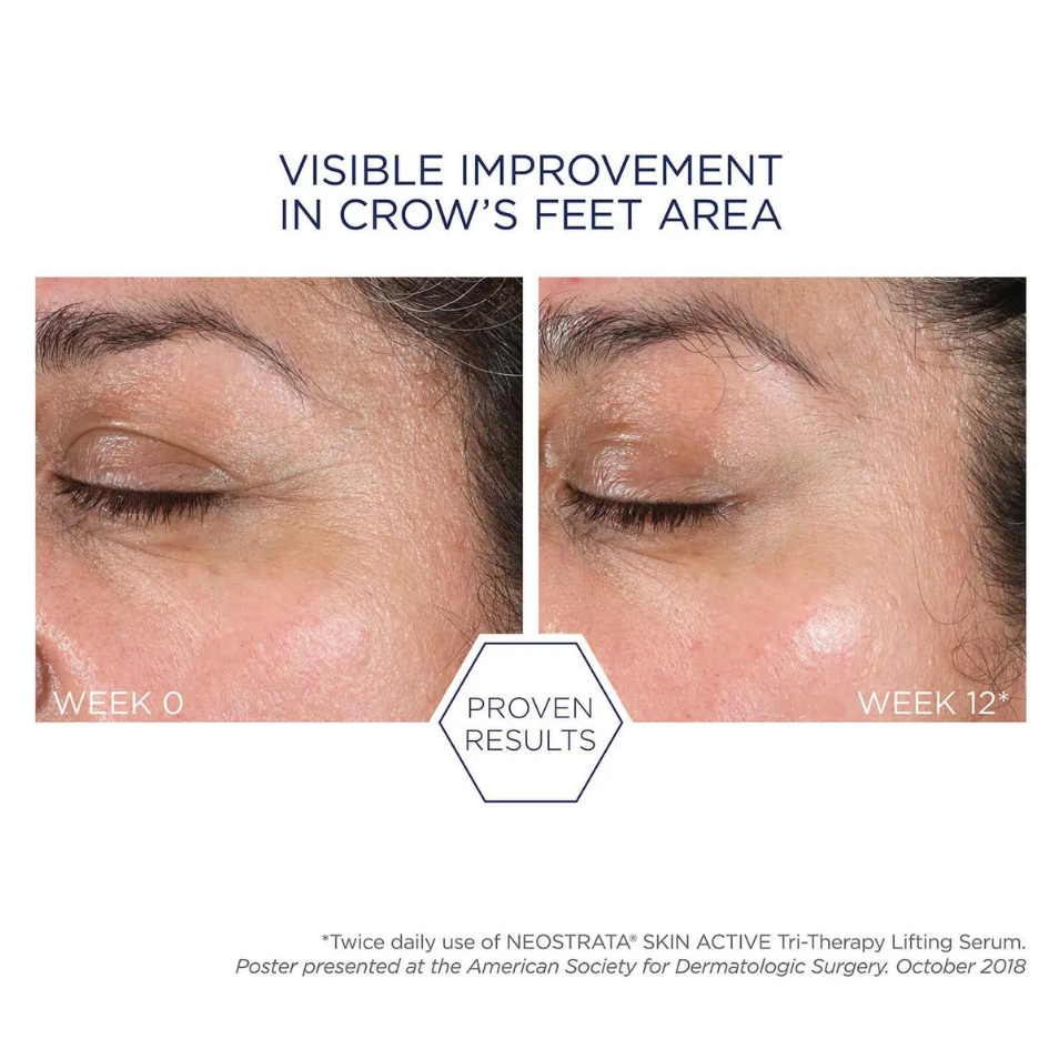 NEOSTRATA Skin Active FIRMING Tri-Therapy Lifting Serum 30ml: Advanced firming serum for a lifted and rejuvenated complexion, promoting skin elasticity and reducing the appearance of fine lines and wrinkles