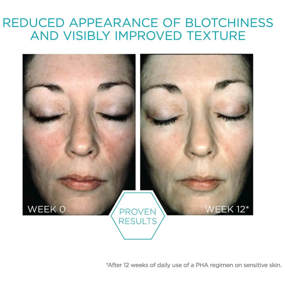 Restore Bionic Face Cream 40g: Nourishing facial cream with advanced restorative properties for hydrated and revitalised skin
