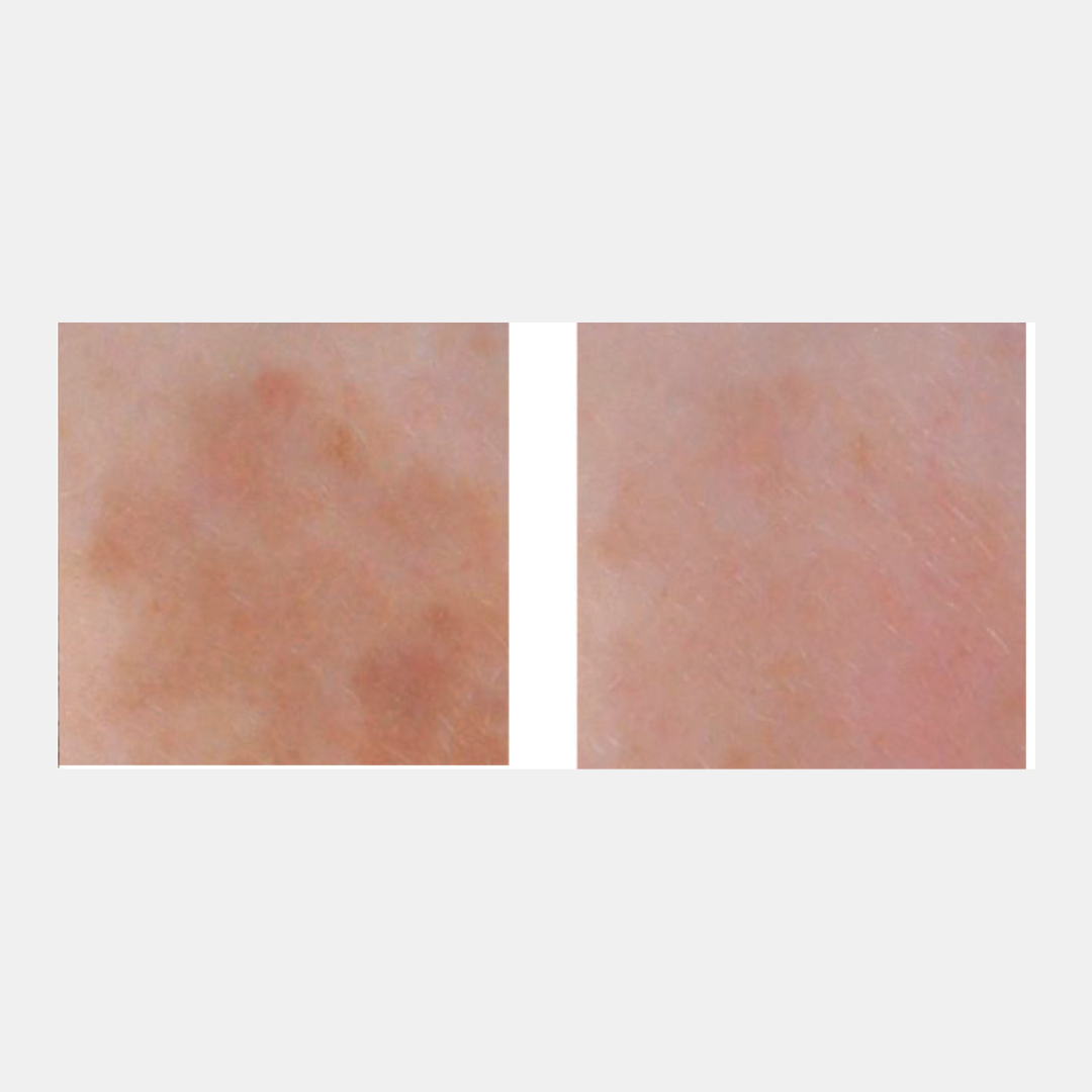 CEBELIA-Reinforced-Depigmenting-30ml