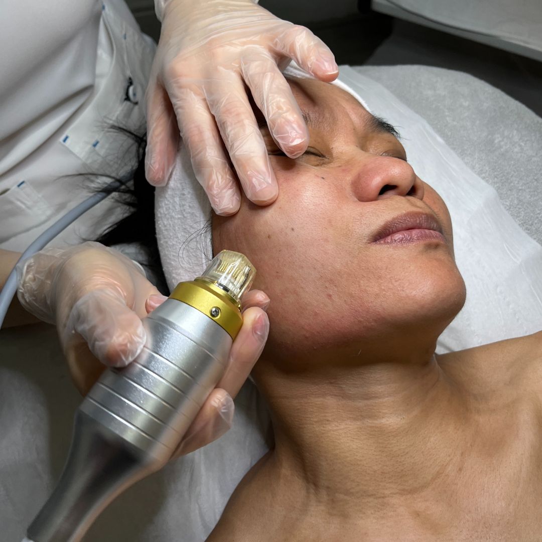 Fractional RF x1 Session