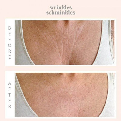 Wrinkles Schminkles WRINKLES SCHMINKLES Chest And Decolletage Smoothing Kit .