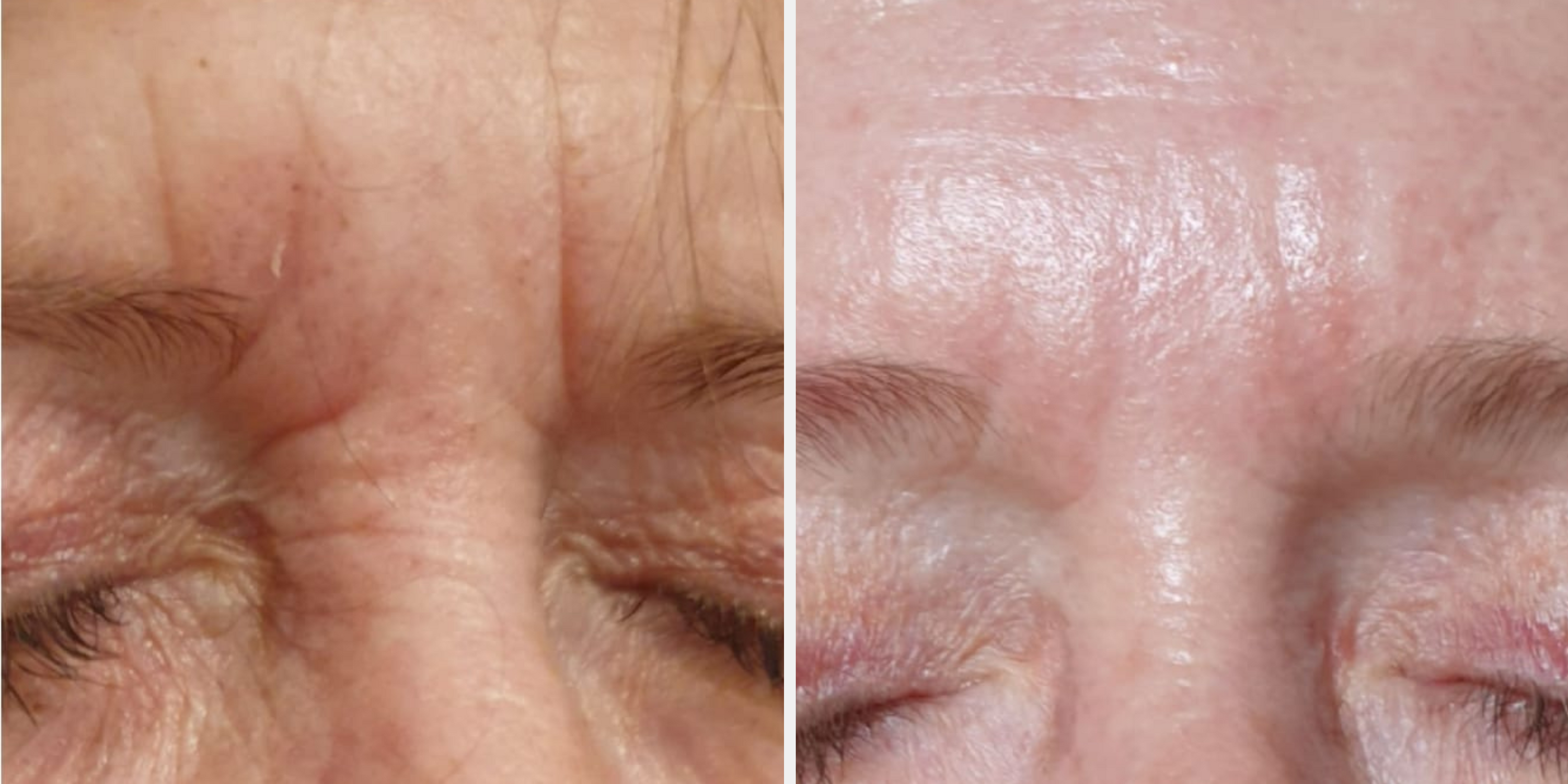 Reduce the Appearance of Fine Lines and Wrinkles with iS Clinical Youth Eye Complex