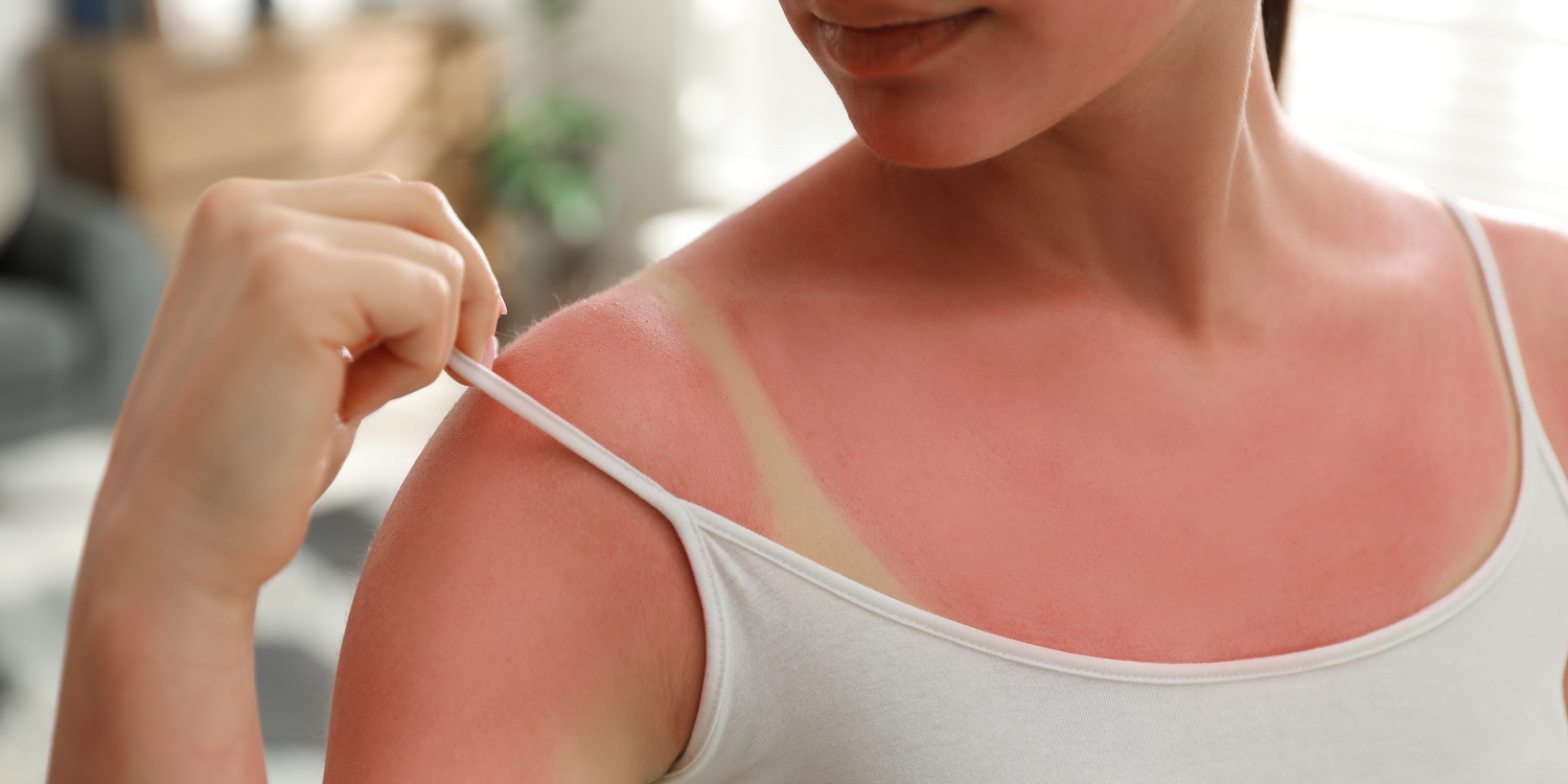Protect Your Skin from UV Damage with Medik8 Suncream