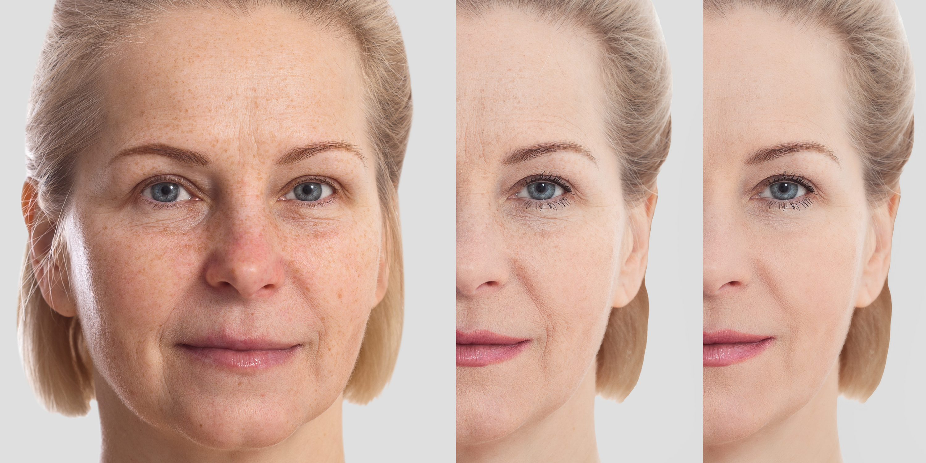How Skinceuticals Anti-Ageing Skincare Products Can Help You Look Younger