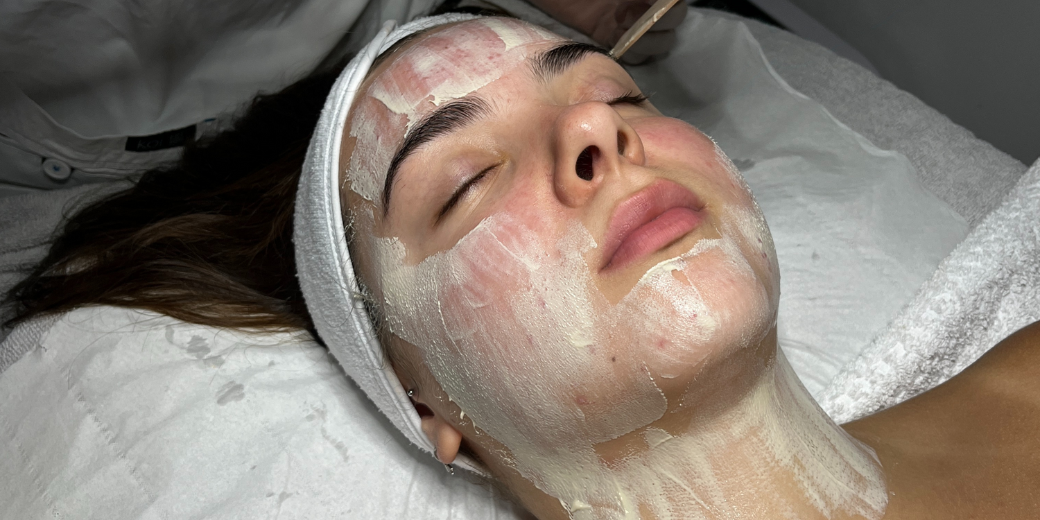 Transform Your Skincare Routine with the Power of Skin Peels