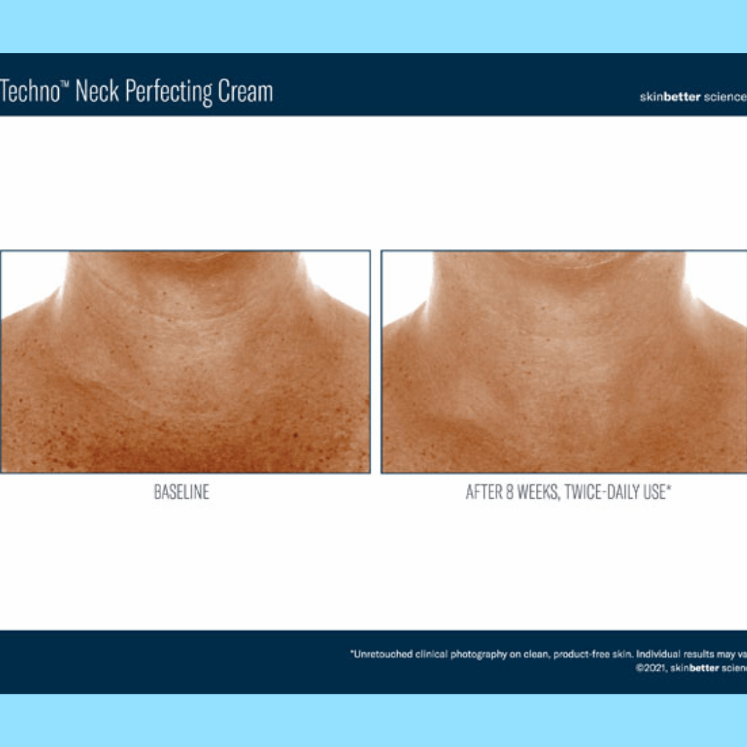 Experience the power of SKINBETTER SCIENCE Techno Neck Perfecting Cream. This advanced formula targets visible signs of aging on the neck and décolleté, delivering a firmer, smoother, and more youthful-looking appearance.