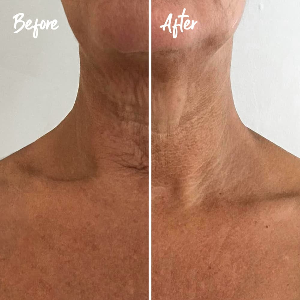 INSTANT EFFECTS Neck &amp; Chest Rejuvenating Serum 30ml: Renew and revitalise your neck and chest with the INSTANT EFFECTS Neck &amp; Chest Rejuvenating Serum, a potent formula that helps tighten and smooth the skin, reducing the signs of ageing for a youthful and radiant décolletage.