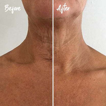 INSTANT EFFECTS Neck &amp; Chest Rejuvenating Serum 30ml: Renew and revitalise your neck and chest with the INSTANT EFFECTS Neck &amp; Chest Rejuvenating Serum, a potent formula that helps tighten and smooth the skin, reducing the signs of ageing for a youthful and radiant décolletage.