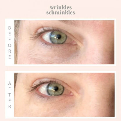 Wrinkles Schminkles WRINKLES SCHMINKLES Eye Smoothing Kit | Beautology.