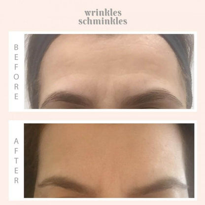 Wrinkles Schminkles WRINKLES SCHMINKLES Forehead Smoothing Kit | Beautology.